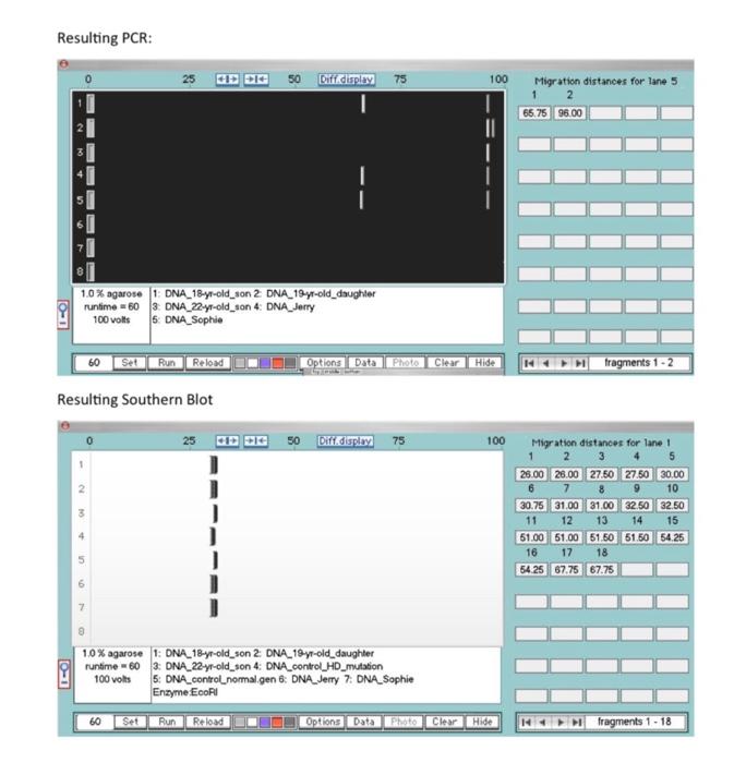 Solved Resulting PCR: 25 50 Difcipley 75 100 Migration | Chegg.com