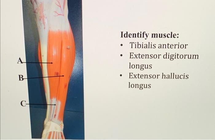 Identify muscle: - Tibialis anterior - Extensor digitorum longus - Extensor hallucis longus