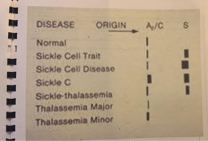 DHSEASE
ORIGIN \( \longrightarrow A_{2} / \mathrm{C} \quad \mathrm{S} \)
Normal
Sickle Cell Trait
Sickle Cell Disoase
sickle 