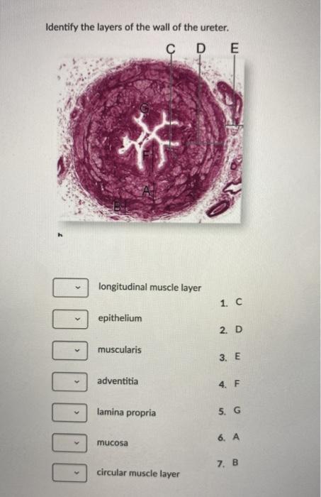 Solved Identify The Layers Of The Wall Of The Ureter C D Chegg Com