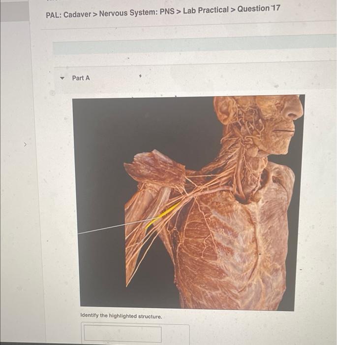 PAL: Cadaver > Nervous System: PNS > Lab Practical > Question 17
Part A
Identify the highlighted structure.