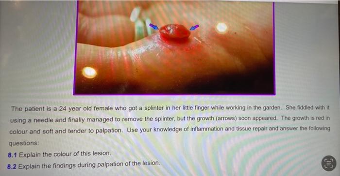 Solved The patient is a 24 year old female who got a | Chegg.com