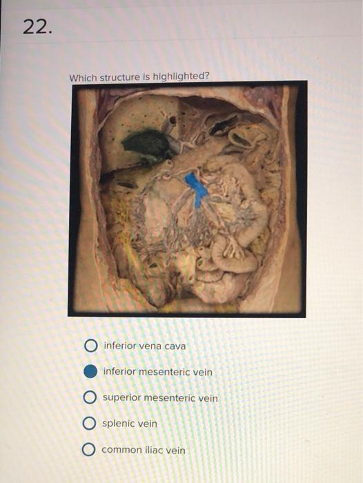 Solved 22. Which structure is highlighted? inferior vena | Chegg.com