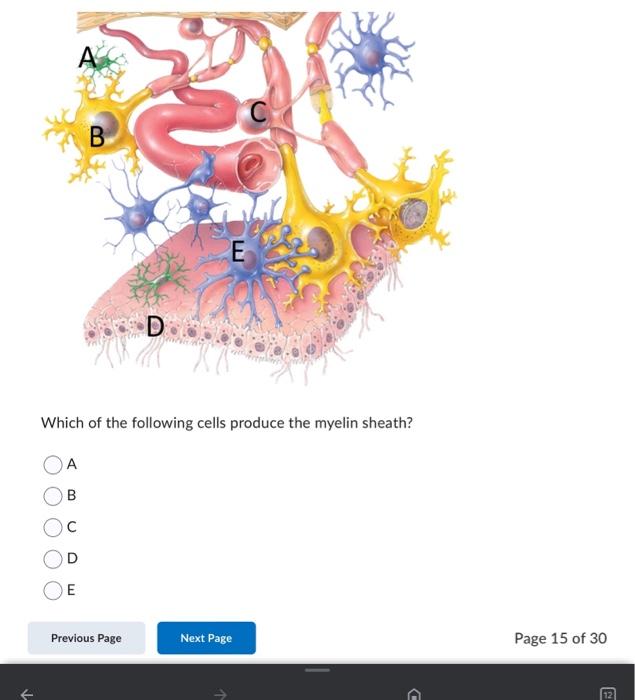 Solved central sulcus parietal lobe lateral sulcus occipital | Chegg.com