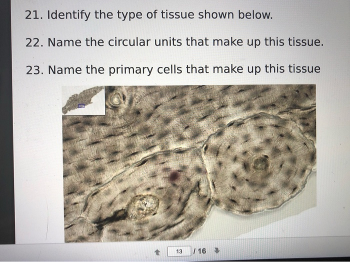 Solved 21. Identify the type of tissue shown below. 22. Name