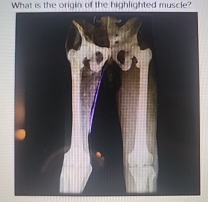 Solved What is the origin of the highlighted muscle? | Chegg.com