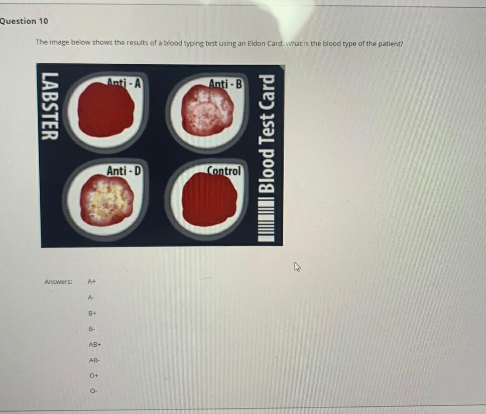 Solved Question 10 The image below shows the results of a | Chegg.com
