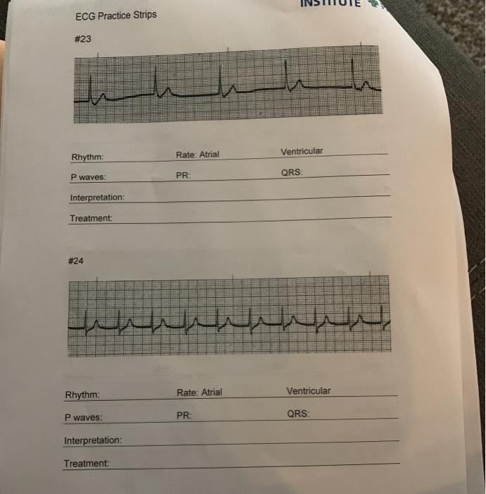 Solved ECG Practice Strips 23 Ventricular Rhythm: Rate: | Chegg.com