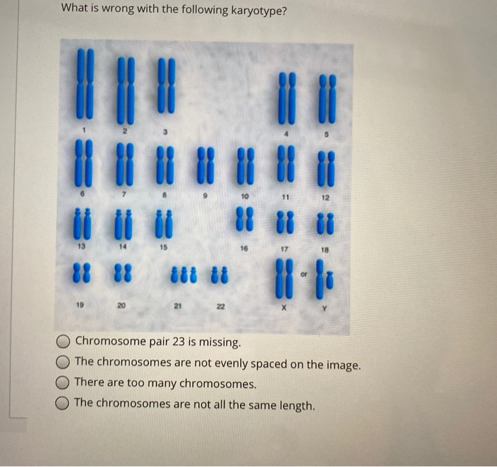 Solved What is wrong with the following karyotype? 18 18 10 | Chegg.com