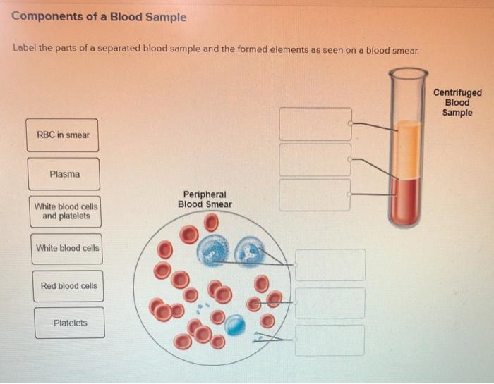 Solved Components of a Blood Sample Label the parts of a