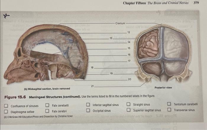 Solved 378 Chapter Fifteen The Brain and Cranial Nenves | Chegg.com