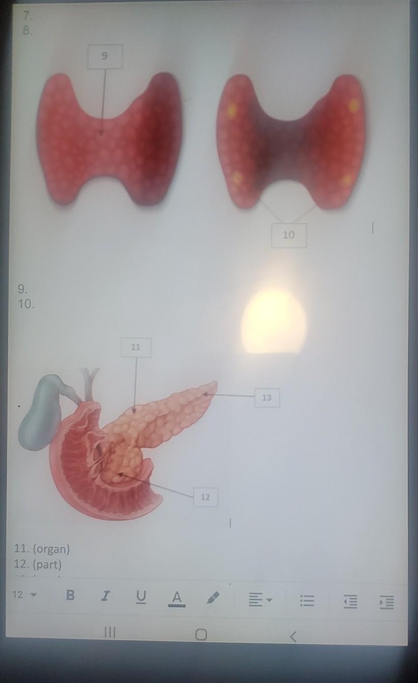 Solved Anatomy Of The Endocrine System Lab Student Answer | Chegg.com