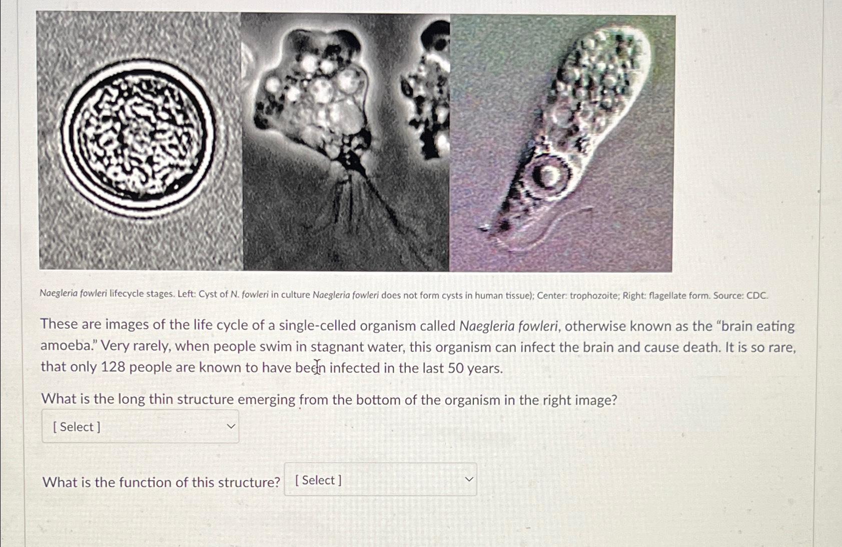 solved-naegleria-fowleri-lifecycle-stages-left-cyst-of-n-chegg