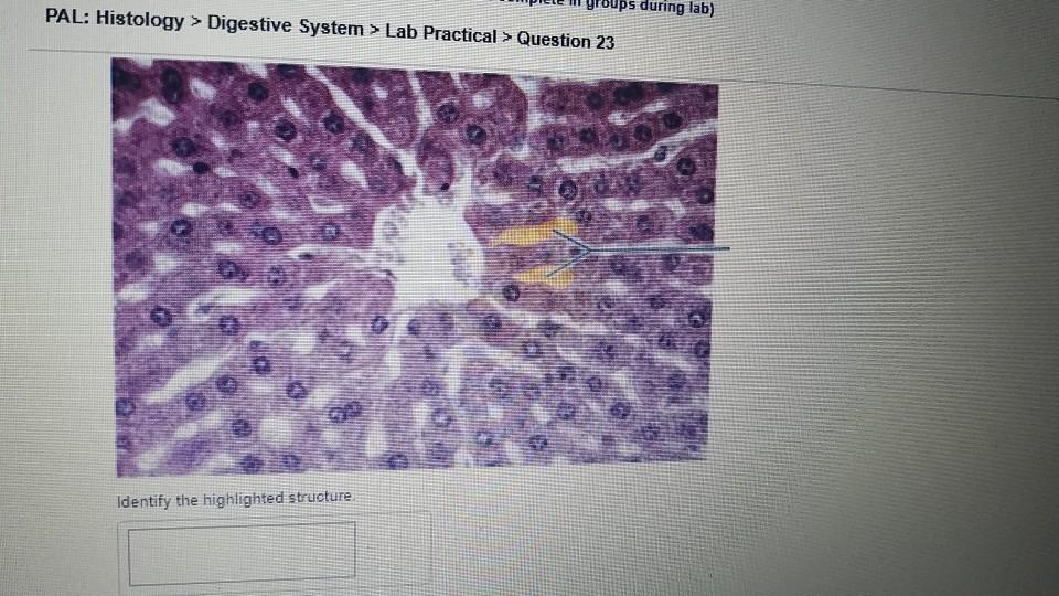 solved-ps-during-lab-pal-histology-digestive-system-chegg