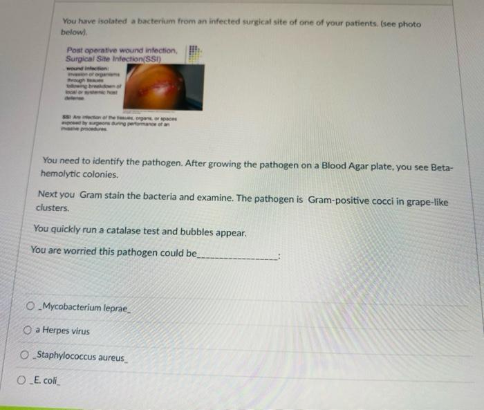 Solved You have isolated a bacterium from an infected | Chegg.com