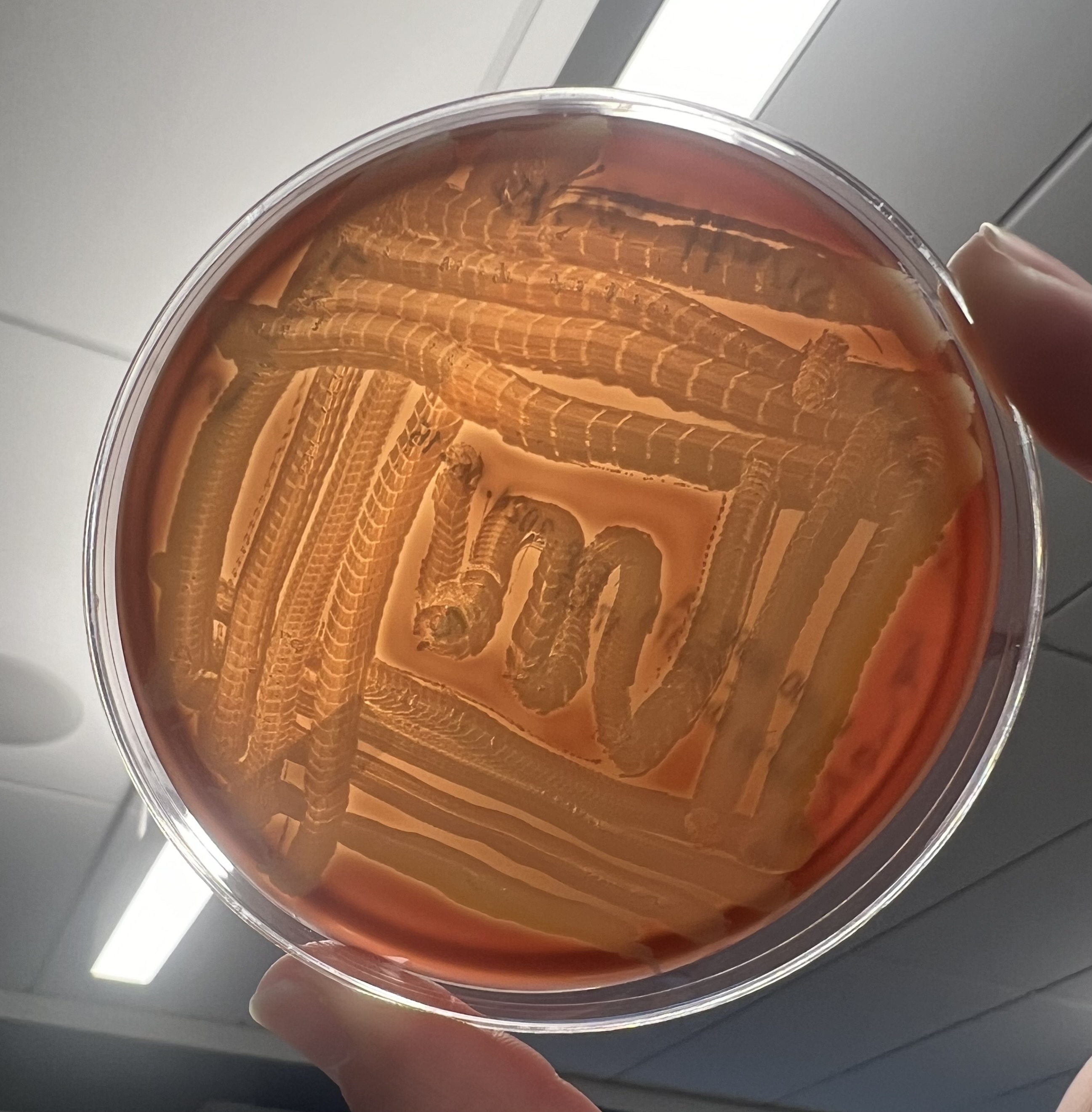 Hemolysis Index 0 24: What Does It Really Mean? - egqafk5