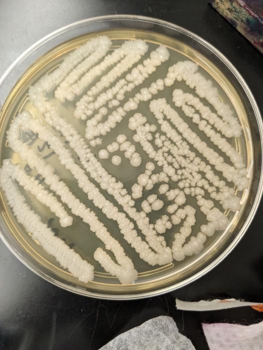 Solved This is for Microbiology.Starch & nutrient agar. | Chegg.com