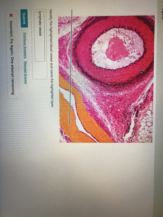 Solved Identify the highlighted structure. Submit Request | Chegg.com