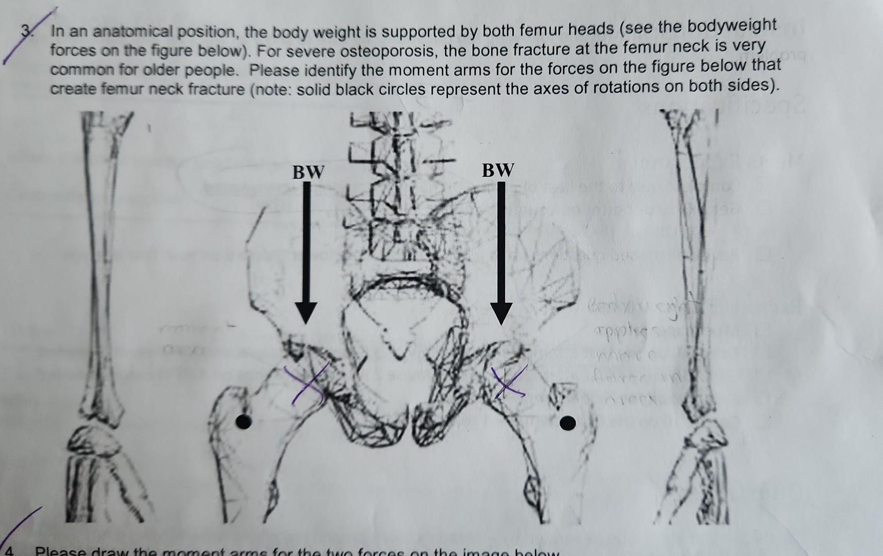 In an anatomical position, the body weight is