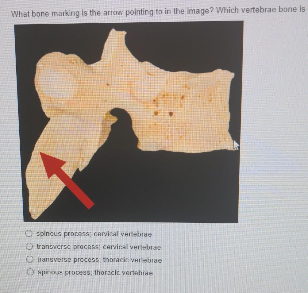 Solved What bone marking is the arrow pointing to in the | Chegg.com