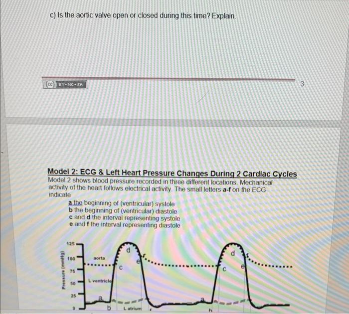 Solved Heart Valves and the Cardiac Cycle Model 1: Opening | Chegg.com
