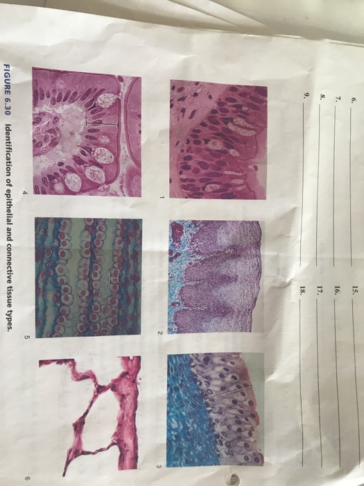 Solved protocol FIGURE 6.30 Identification of epithelial and | Chegg.com