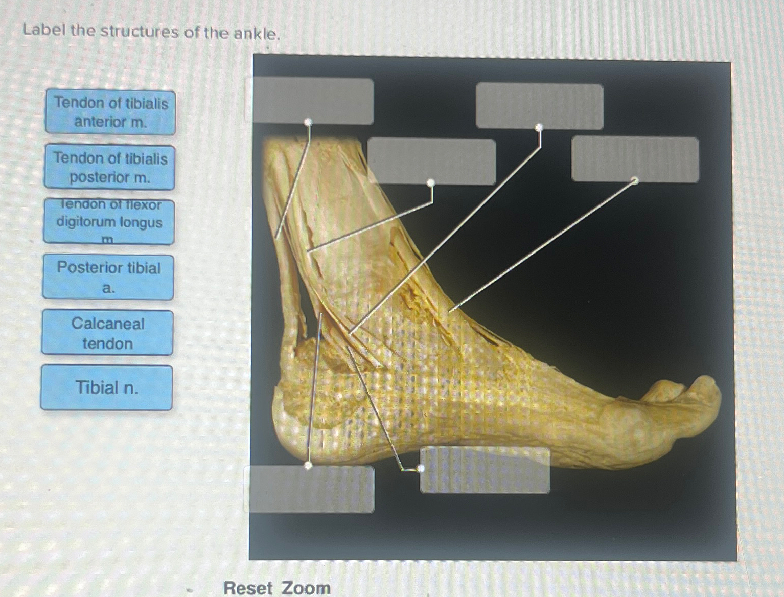 Solved Label the structures of the ankle.Reset Zoom | Chegg.com