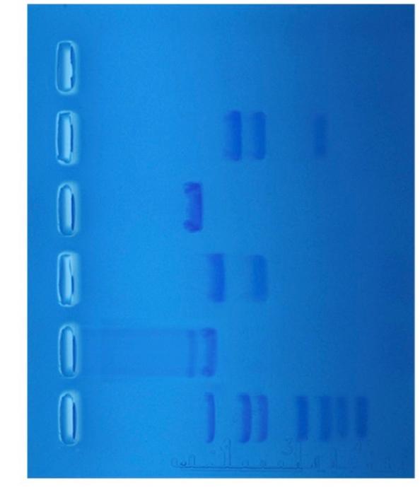Solved Summary of Restriction Enzyme Digestion Reactions | Chegg.com