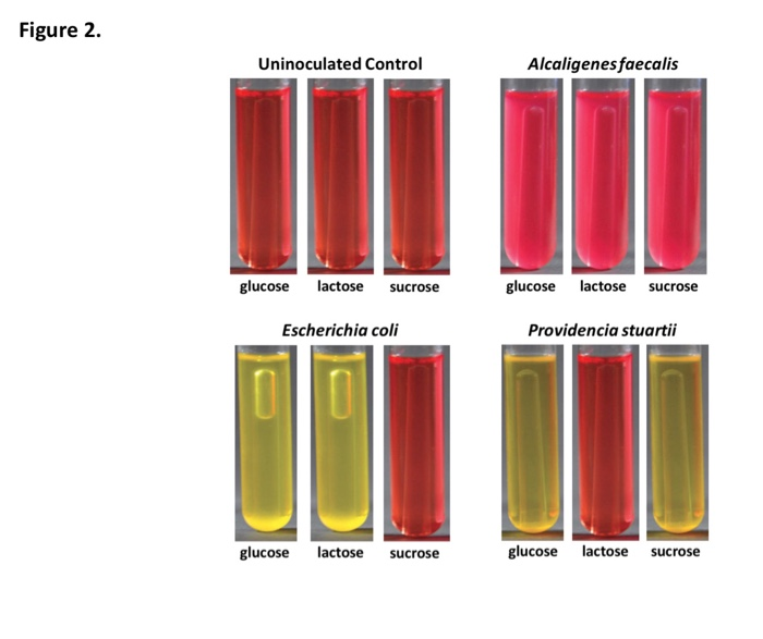 Solved Assume PRglucose, PRlactose and PRsucrose tubes