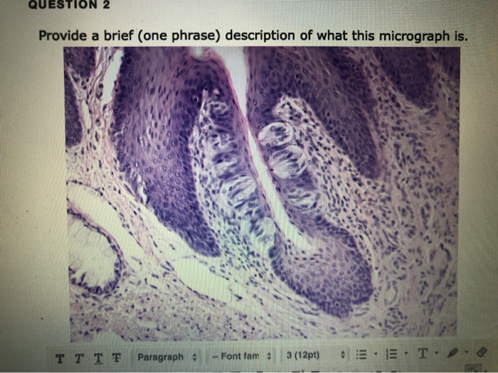 Micrograph Caption Examples Solved QUESTION 2 Provide a brief (one phrase) description | Chegg.com