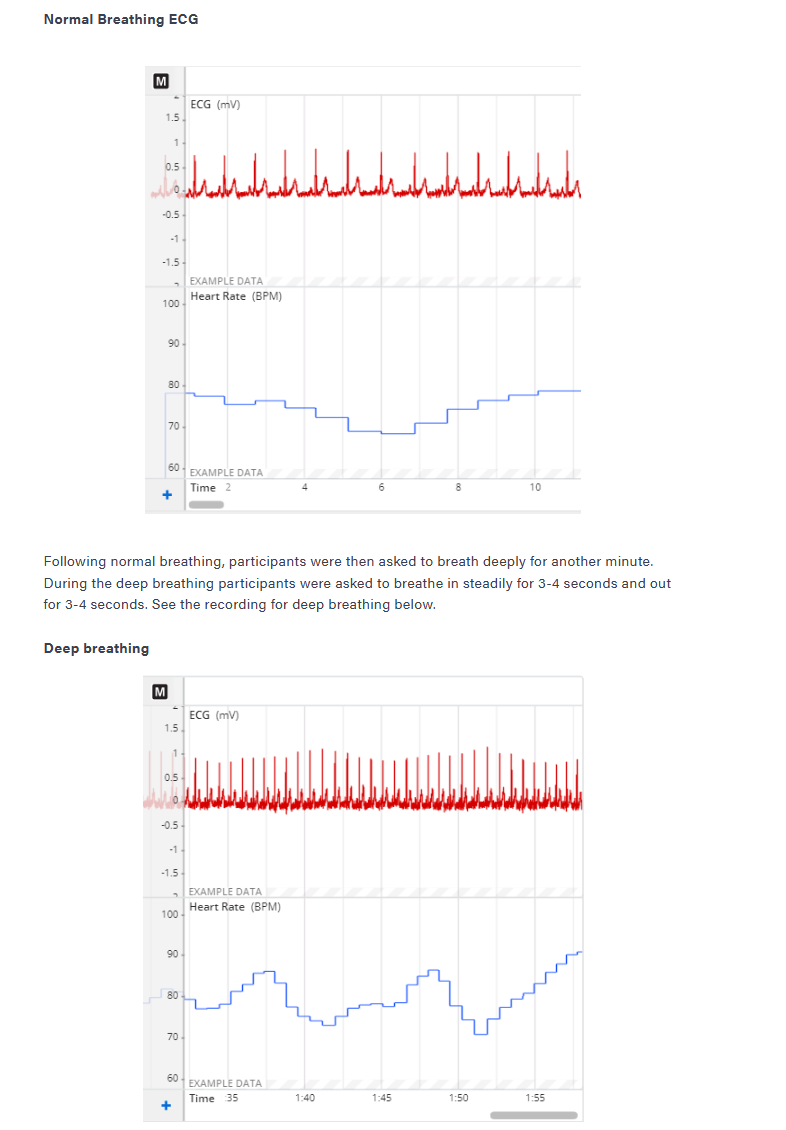 Solved Was there greater heart rate variability during quiet | Chegg.com