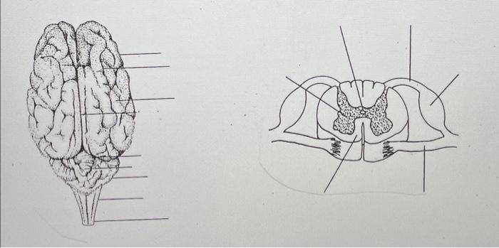 Solved Need help to label the brain dissection of pig fetal, | Chegg.com