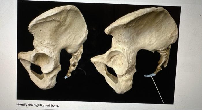 Identify the highlighted bone.