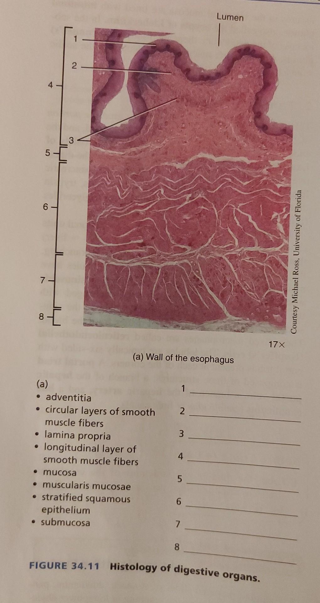 Solved (a) Wall of the esophagus (a) - adventitia - circular | Chegg.com