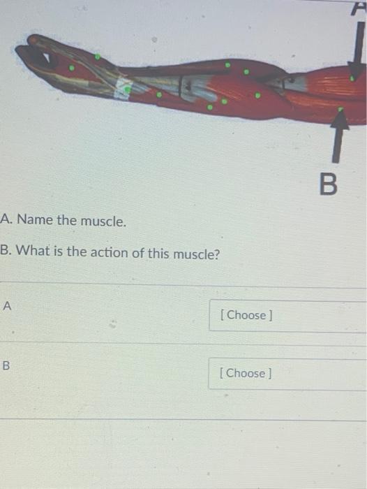 Solved A B A. Name The Muscle. B. What Is The Action Of This | Chegg.com