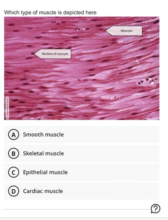 Solved Which type of muscle is depicted here Nucleus of | Chegg.com