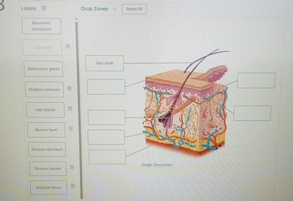 Solved Label parts of the skin | Chegg.com