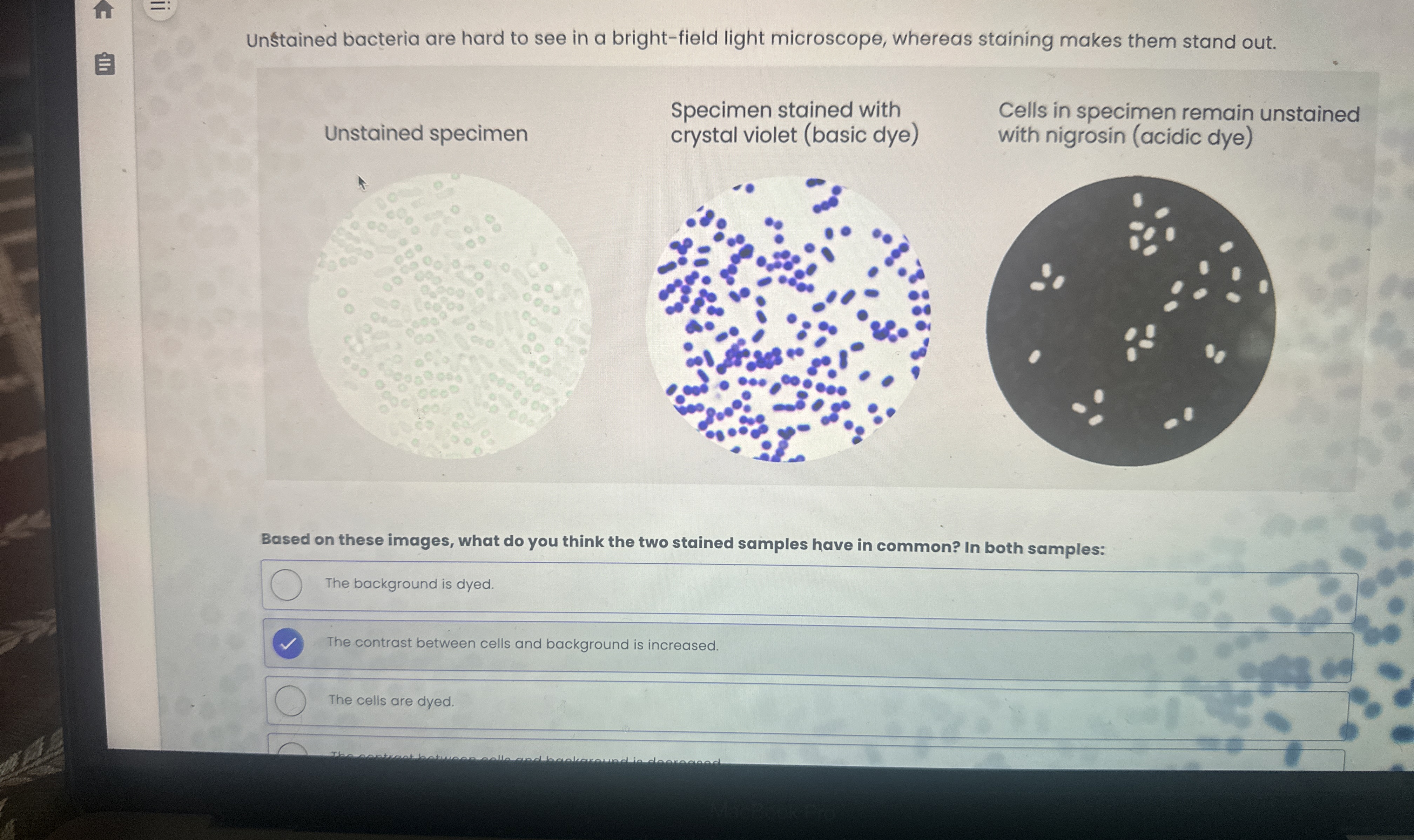 Solved Unstained bacteria are hard to see in a bright-field | Chegg.com