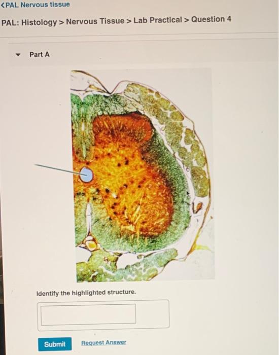 Solved Nervous Tissue > Lab Practical > Question 4 Part A | Chegg.com