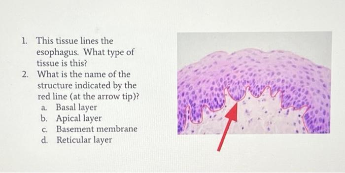 solved-1-this-tissue-lines-the-esophagus-what-type-of-chegg