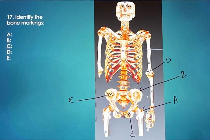 Solved 14. Identify The Type Of Bone: A: B: A B 17. | Chegg.com