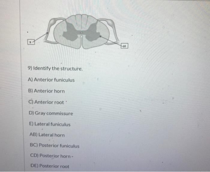 Solved 20 9) Identify the structure. A) Anterior funiculus | Chegg.com
