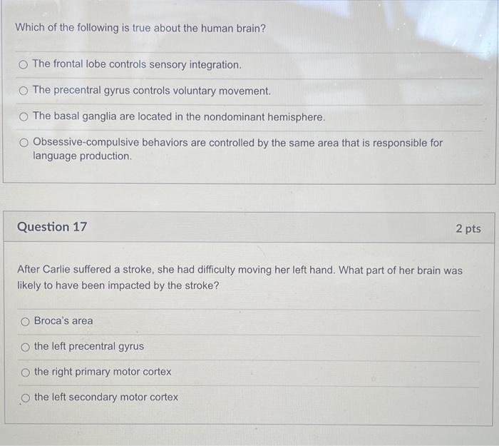 Solved Which of the following is true about the human brain? | Chegg.com