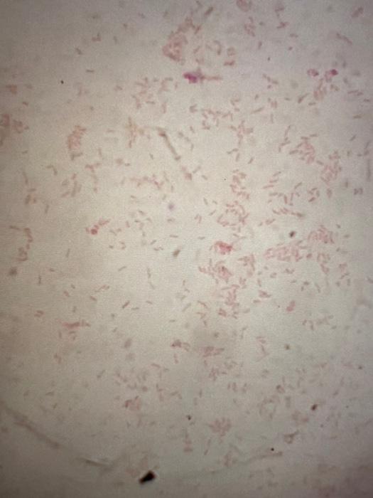 Solved I did the gram stain of an unknown bacteria so that i | Chegg.com