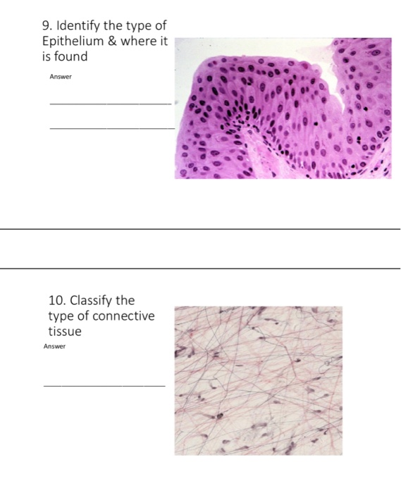 Solved 9. Identify the type of Epithelium & where it is | Chegg.com