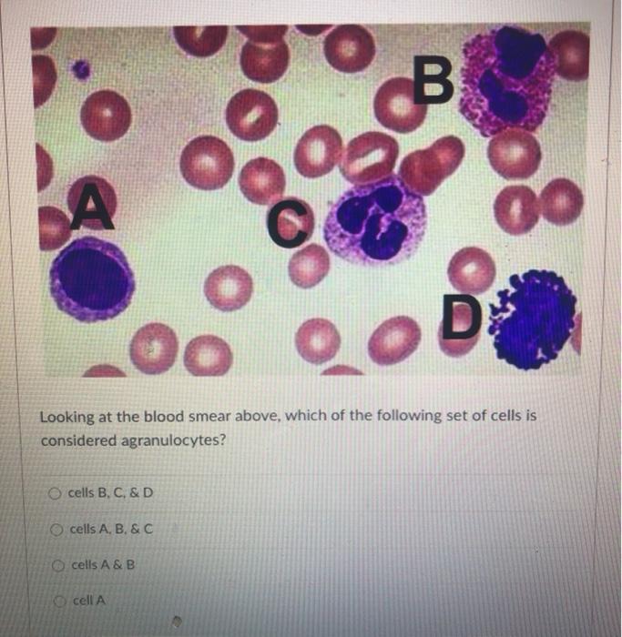 Solved B A O Looking At The Blood Smear Above, Which Of The | Chegg.com