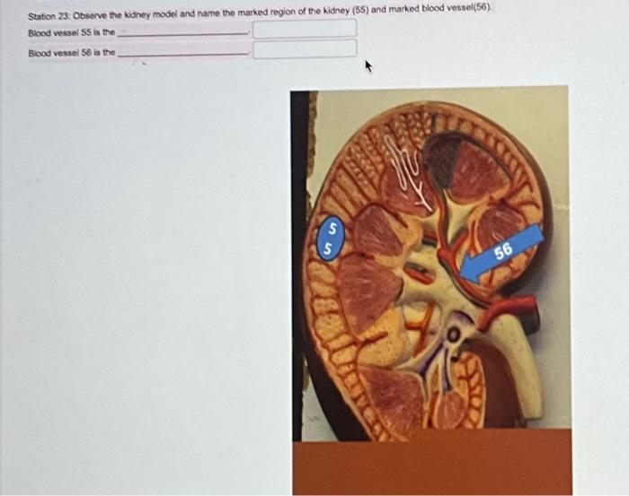 Solved Station 23: Observe the kidney model and name the | Chegg.com