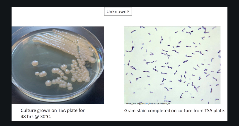 Solved Are these Gram negative or Gram positive? Which shape | Chegg.com