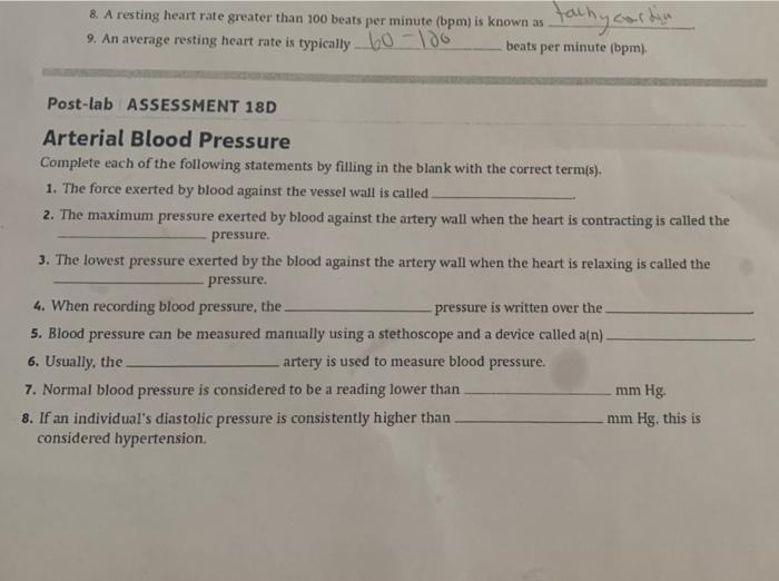 Heart Rate Greater Than 100 Beats Per Minute
