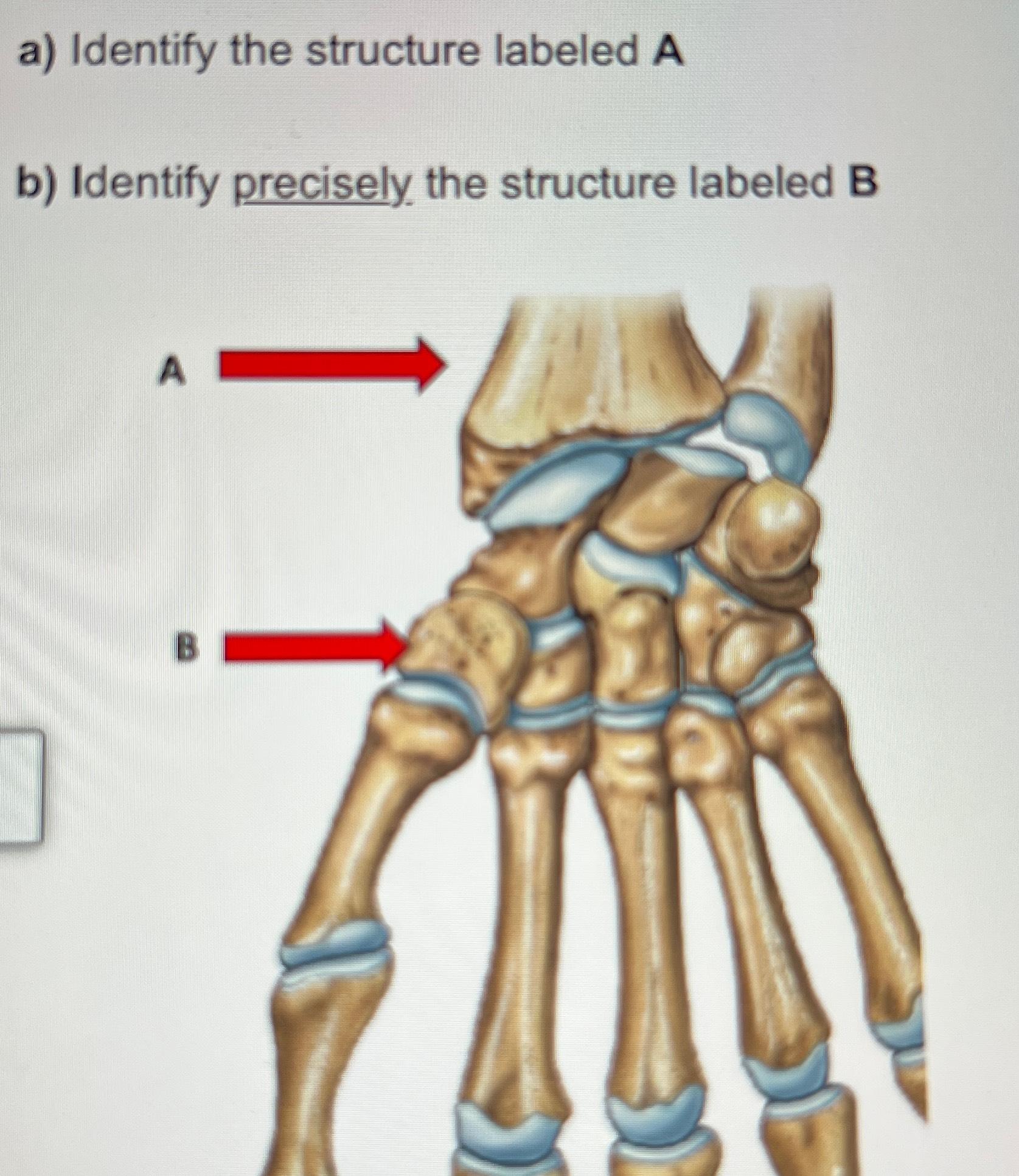 Solved A) ﻿Identify The Structure Labeled Ab) ﻿Identify | Chegg.com